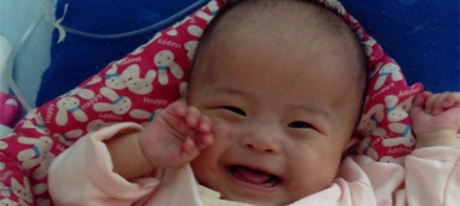 Preterm Baby Beats the Odds with Lifesaving Surgery Meng Yao and her twin sister were preterm babies, weighing only 4.5 pounds, and were given a slim chance of survival by physicians.